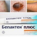 Murdăriți pentru a evita ploșnițe mușcătoare prezentare generală a ploșnițe mușcăturile (muscat) Murdăriți pentru a evita ploșnițe mușcătoare imagine de ansamblu a ploșnițe mușcăturile