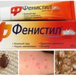 Murdăriți pentru a evita ploșnițe mușcătoare prezentare generală a mușcăturilor de ploșnițe (ploșnițe) Murdăriți pentru a evita ploșnițe mușcătoare imagine de ansamblu a ploșnițe mușcăturile
