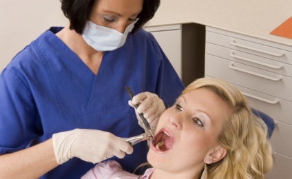 Flux după extracția dentară, care fac vitaportal - Sanatate si Medicina
