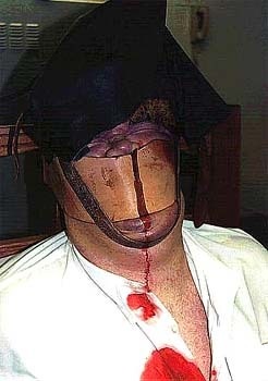 Electrocutarea (scaun) electrocutare