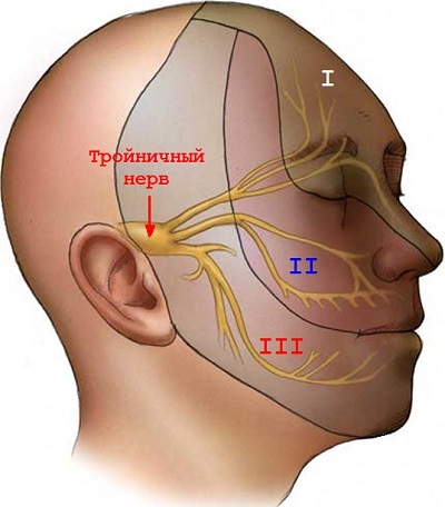 nervului trigemen (nevralgie de trigemen) Prosoponeuralgia