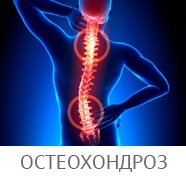 Exacerbarea osteocondrozei de col uterin-toracice a coloanei vertebrale, eliminând cel mai puternic atac