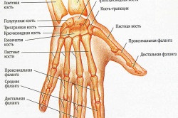 braț perie simptome fractura si tratament