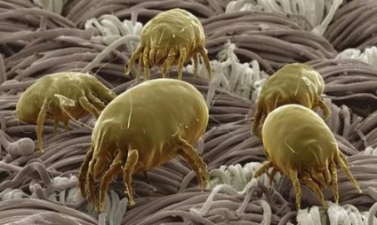 Viermi și tipurile lor de pat. Oxiuriază - Wikipedia