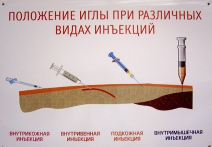 Tipuri de injectare (administrat strat adipos subcutanat) injecție tipuri