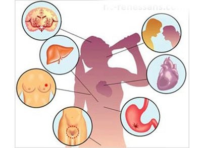 Efectele alcoolului asupra corpului femeii și a sistemului de reproducere feminin (de reproducere) Efectele alcoolului asupra corpului femeii și a sistemului reproductiv feminin