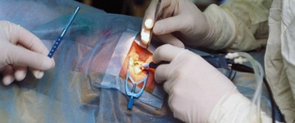 Miopiei la copii miopie, miopie cauze, tratament și corectarea miopiei cu ochelari și (copii) Miopiei la copii miopie, miopie cauze, tratament și corectarea miopiei cu ochelari și