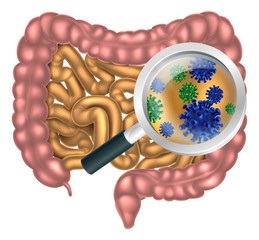 Tuberculoza intestinala simptome, diagnostic, tratament