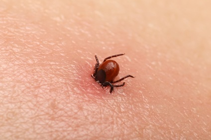 Alergiile să muște simptomele și tratamentul tick (simptome) Alergia la căpușe simptome mușcături și tratament