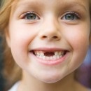 Tipuri de malocclusion și grade (anomalii) Tipuri de malocclusion și grade