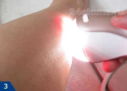 Acasă photoepilator - comentarii, un rating cumpăra mai bine în 2016 (photoepilator) Acasă photoepilator - comentarii, un rating cumpăra mai bine 2016
