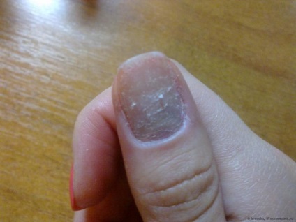 Gel lac de unghii sau obișnuită pe care o selectați (normal) Gel lac de unghii sau obișnuită pe care o alegeți