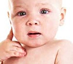 Limfatiko-hipoplazie diateză - cauze, simptome, diagnostic și tratament (simptome) Limfatiko-hipoplazie diateză - cauze, simptome, diagnostic și tratament