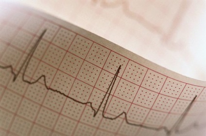Modificări metabolice ale miocardului - ceea ce este (modificările metabolice ale miocardului) Modificări metabolice ale miocardului - ceea ce este