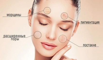 Peelingul mecanice faciale ce este, indicații, contraindicații (persoană) Peelingul mecanice faciale ce este, indicații, contraindicații