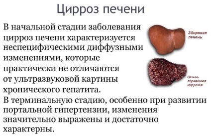De ce neagă picioare la alcoolici (de ce) De ce neagă picioare la alcoolici