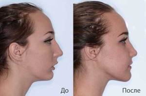 Chiar și musca greșit o persoană - vederi de fotografii, efectele (specii) musca pe dreapta și greșit un om - specie cu fotografii, efecte