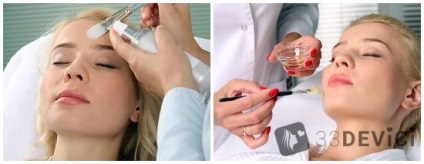 Coji de salicylic pentru față de lectură, fotografii și comentarii (comentarii) Coji de salicylic pentru față de lectură, foto, comentarii