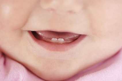Date dentitie, simptome dentitie și măsuri pentru a elimina simptomele nedorite (dentiție) Perioada de dentiție simptome dentitie și măsuri pentru a elimina simptomele nedorite