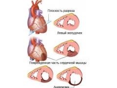 Atrial septal anevrism la copii, fie că este vorba de periculos, dacă este necesar pentru a trata