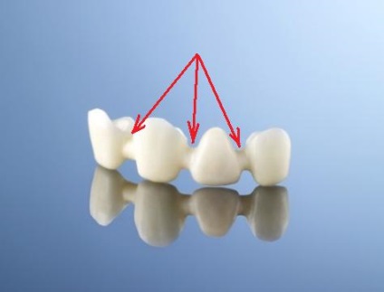 Halitozei, sau de ce mirosuri neplăcute din gura, perfectsmile