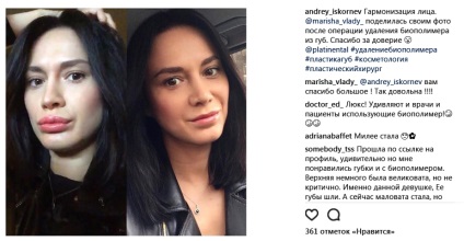 buzele rață nu mai la modă (la fel ca și fetele de sus buzele rață rață rață fotografie boală utkoobraznaya forma gurii) buzele rață nu mai la modă