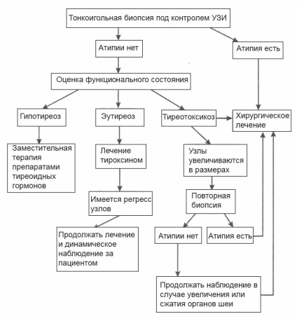 нодуларна гуша