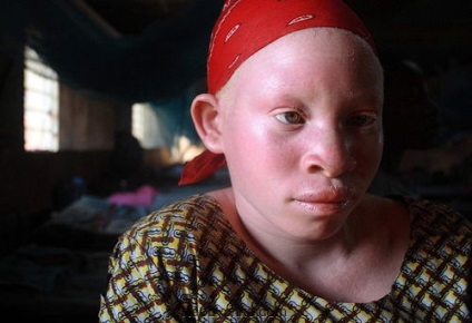 10 fapte veridică asupra oamenilor și animalelor albinoși (animale) 10 fapte veridică asupra oamenilor și a animalelor albino