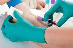 Alergic la banane și simptomele sale (alergice) Alergic la banane și simptomele sale