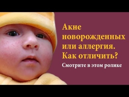 Alergia la sugari (lapte de capră de vacă lui) Alergiile la sugari