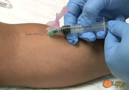 Ce se întâmplă în cazul în care o venă pentru a injecta aer Mituri și realitate (venă) Ce se întâmplă în cazul în care o venă pentru a injecta aer mituri și realitate