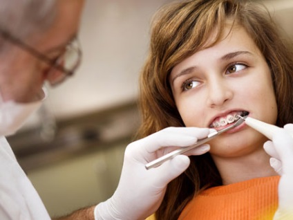 Ce ortodont medicul (dentist ortodont pentru a face o zi acolade dentare sunt o profesie buna pentru a trata) Ce ortodont medicul