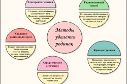 Ce se întâmplă dacă doare un mol (nev) Ce se întâmplă dacă doare birthmark