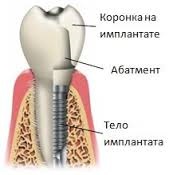 implantare endoscopic la Moscova (a) implantare endoscopica la Moscova