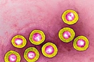 Herpes pe buzele cauzele și tratamentul (aspect) Herpes pe buzele cauzele și tratamentul