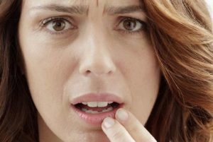 Herpes pe buzele cauzele și tratamentul (aspect) Herpes pe buzele cauzele și tratamentul