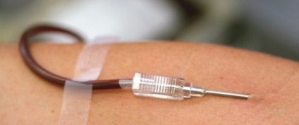 Bleed beneficiile si dauneaza (zona deteriorat circulator) Bleed beneficiile si dauneaza