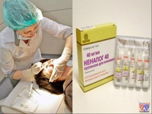 Tratamentul șalazion - normale, aleatoare, populară, Homeopatie (Homeopatie) Tratamentul șalazion - normale, aleatoare, popular, homeopatie