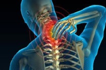 Medicamente cu osteohondroza (droguri) Medicamente în osteocondrozei