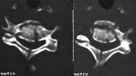 Metode radiale de investigare a sistemului musculo-scheletice (metode) Metode radiale de investigare a sistemului musculo-scheletic