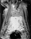 Metode radiale de investigare a sistemului musculo-scheletic (cercetare) Metode radiale de investigare a sistemului musculo-scheletic