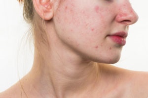 Ulei de riduri faciale salvie pe proprietate și utilizarea (aplicarea) Ulei de salvie proprietăți ridurilor faciale și aplicații