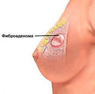 În ce zi a ciclului pentru a face SUA glandelor mamare (glande) În ce zi a ciclului de a face cu ultrasunete de san