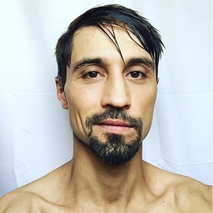 nalyso Shaved Dima Bilan a vorbit deschis despre starea lui de sănătate (lui) nalyso Shaved Dima Bilan a vorbit deschis despre sănătatea lor