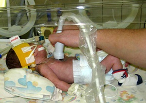 Indicații pentru ultrasunete a inimii a nou-născutului (mărturie) Indicații pentru ultrasunete cardiace la nou-născuți