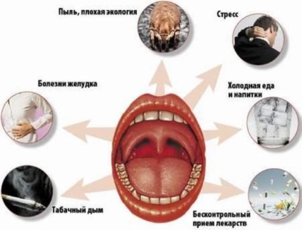 Cauzele durerilor de gât frecvente la adulți și copii purulentă, virale, folicular (angină pectorală) Cauzele durerilor de gât frecvente la adulți și copii purulentă, virale, folicular