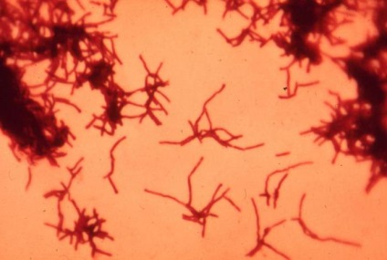 Structura de aminoacizi (aminoacizi) Structura aminoacizilor
