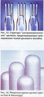 Structura periuțe de dinți moderne (mucoasa parodontal) Structura periuțe de dinți moderne