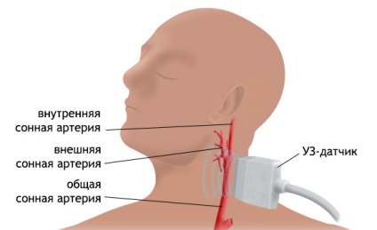 navele triplex de scanare a creierului și a gâtului