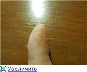 bule de apă din jurul unghiilor pe de o parte, 2 raspunsuri, 38 comentarii, forum de consiliere „Dermatologie (în jur) Apa bule în jurul valorii de unghii pe de o parte, 2 raspunsuri, 38 comentarii, forum pentru sfaturi „Dermatologie
